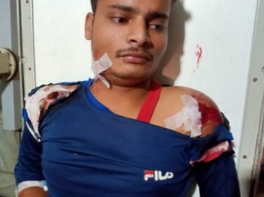 ग्राहक सेवा केंद्र ! गोली मारकर की लूट, दो लूटेरों को ग्रामीणों ने धर दबोचा