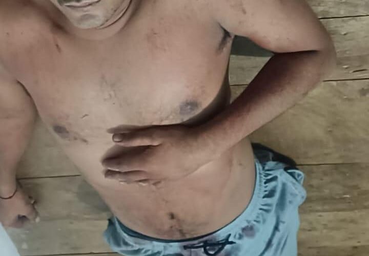 हमलावरों ने किराना व्यवसाई को किया घायल 