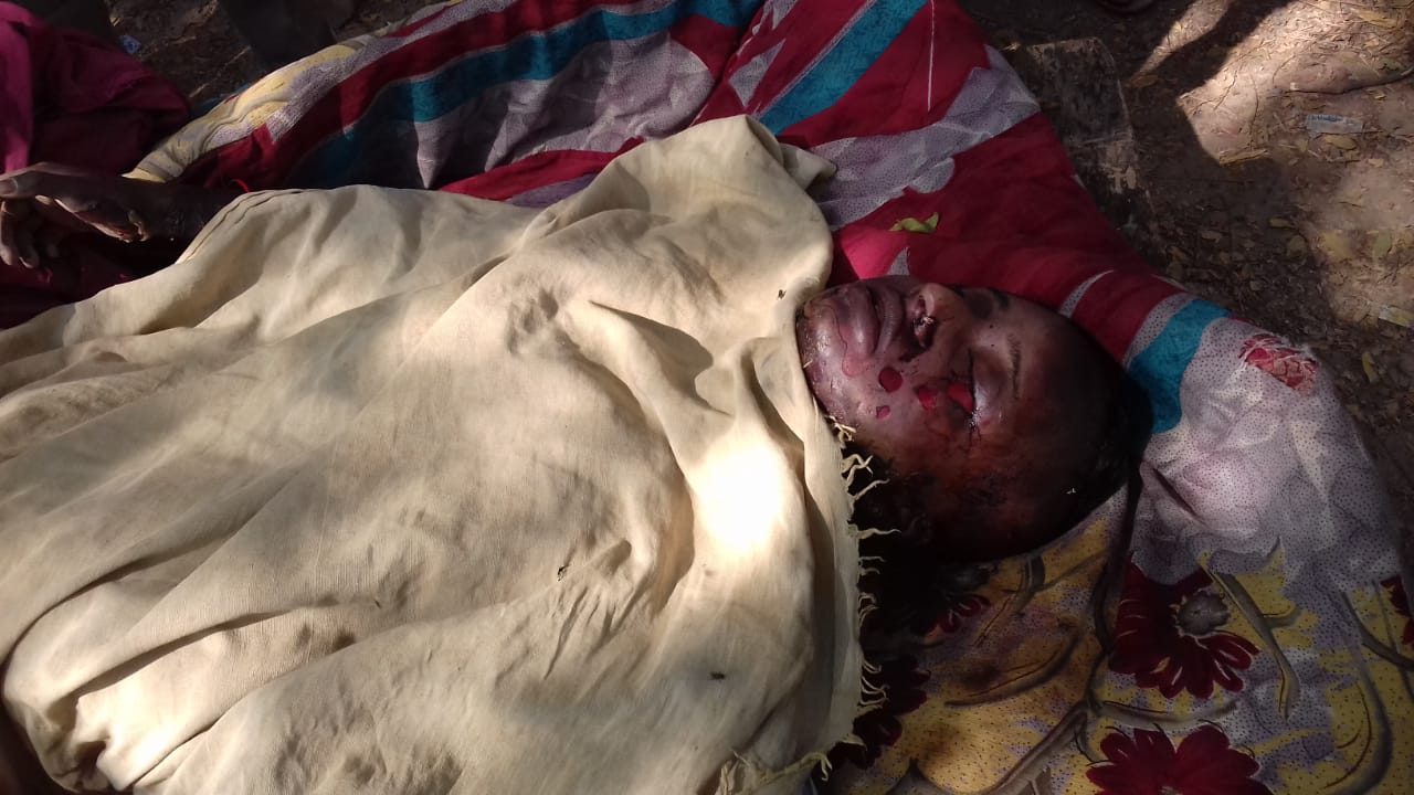 संदिग्ध ! झुलसने से विवाहिता की मौत, पोस्टमार्टम सुलझायेगा गुत्थी