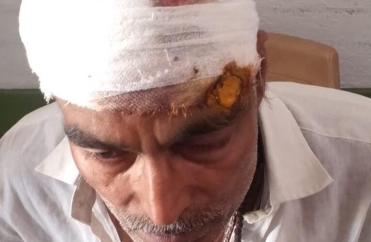 बेटे ने पिता का फोड़ा सिर, मुकदमा दर्ज 