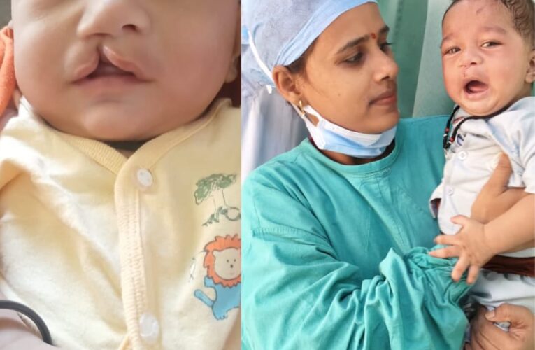जन्मजात ‘क्लब फुट’और  ‘क्लेफ्ट लिप एंड पैलेट’ के बच्चे का हुआ सफल आपरेशन